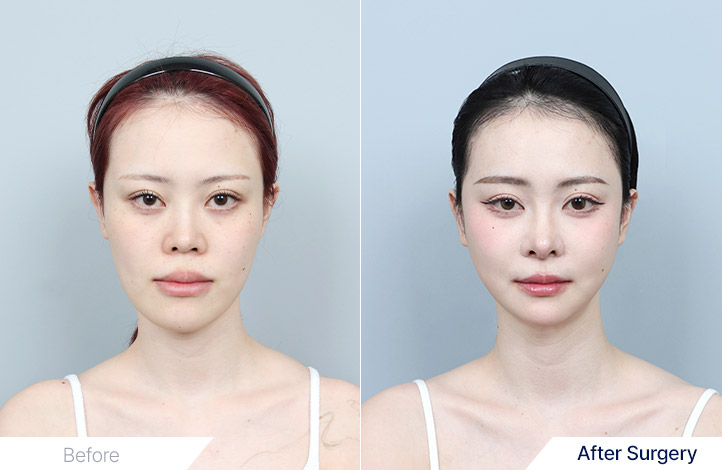 รีวิวจาก DA Plastic Surgery