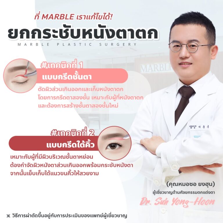 ภาพอธิบายการยกกระชับหนังตาตกของ Marble Plastic Surgery เปรียบเทียบแบบกรีดชั้นตากับแบบกรีดใต้คิ้ว โดยต้องให้แพทย์ประเมินวิธีที่เหมาะสม