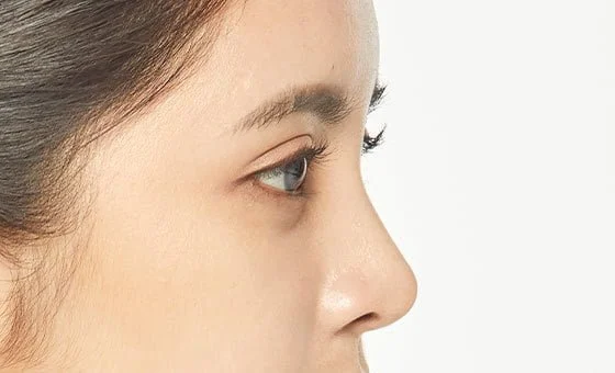 ภาพจมูกมุมด้านข้างจากชุด Augmentation Rhinoplasty ของ Banobagi รูปอ้างอิง 02