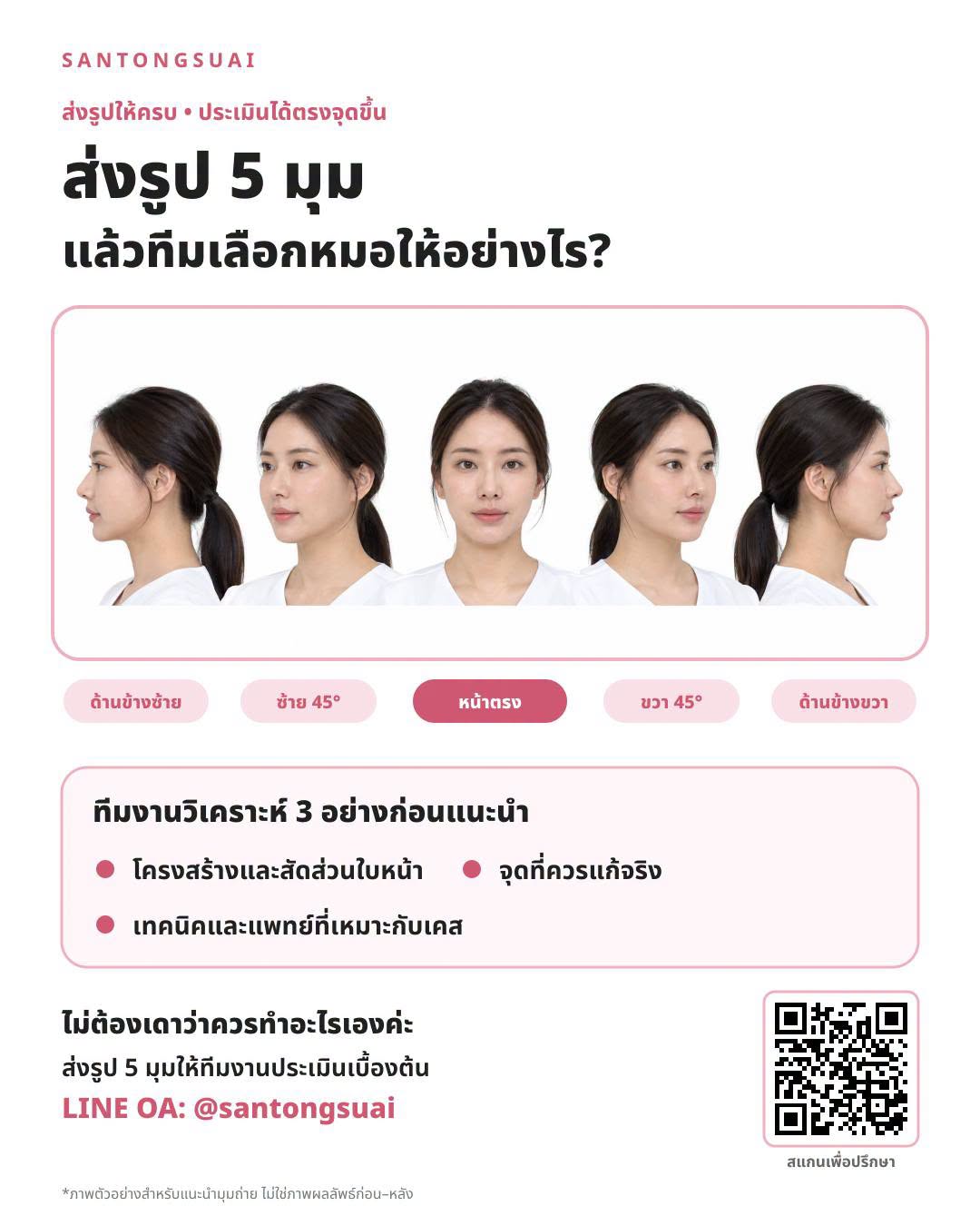 ภาพตัวอย่างมุมถ่ายใบหน้า 5 มุมจากเพจศัลย์ต้องสวย