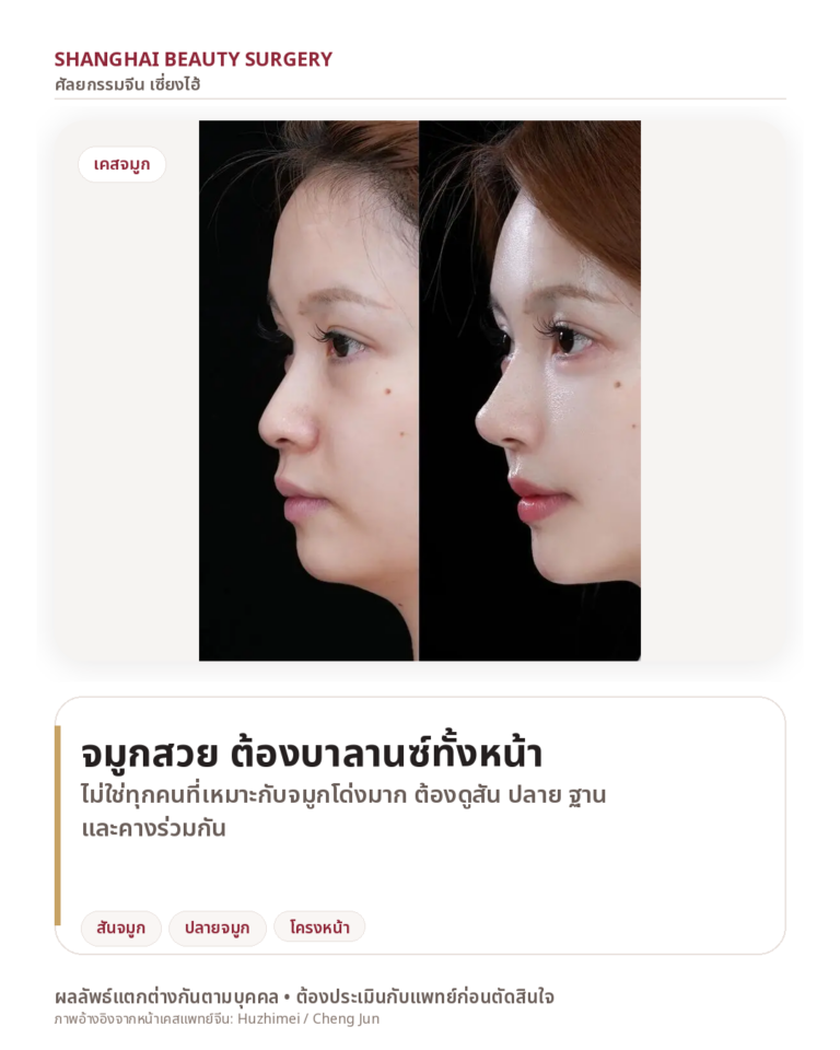 รีวิวทำจมูกจีน Shanghai Beauty Surgery จมูกสวยต้องบาลานซ์ทั้งหน้า