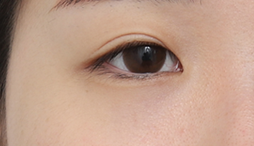 VIEW: ก่อนทำ